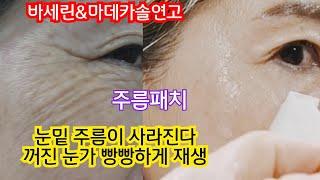 눈가주름이 감쪽같이 사라진다#새살이 솔 솔~/눈가주름.눈가꺼짐을 빠르게 재생시키는 아이패치#