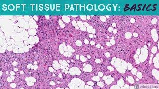 Basic Soft Tissue Pathology Cases: Explained by a Sarcoma Pathologist