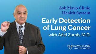 Lung Cancer – Early Detection: Ask Mayo Clinic Health System