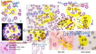 hematology in 10 min:  Peripheral blood smear examination under microscope