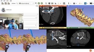 Pedicle screw insertion in virtual reality