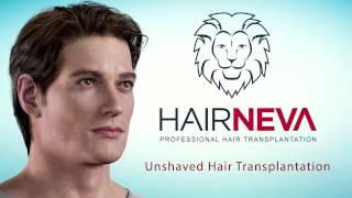 Unshaved Hair Transplantation - HairNeva