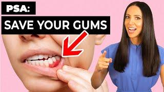 These 4 Things Can SAVE Your GUMS (You Still Have Time!)