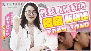 到底該怎麼做痘痘治療｜光動力痘痘治療｜動力光｜囊腫痘痘｜成人痘｜青春痘｜EK美學診所