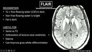 MRI Sequences