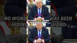 No wonder Trump has been hiding his right hand.#shorts#trump#celebrity