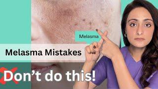 Melasma | Common mistakes | How to treat | Dermatologist