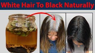 This Oil turned my grey hairs to jet black  | Baal Kale Karne Ka Tarika