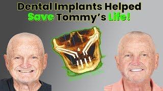 How All on 4 Dental Implants Helped Save This Cancer Survivor's Life!