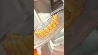 Clear Aligners/Braces Manufacturing  | Clear Moves Aligners