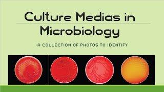 Culture Media in Microbiology