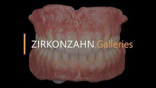 Florence Zircoprox Denture System – All made in zirconia | Zirkonzahn.Galleries