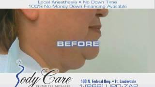Smart Lipo - Ft. Lauderdale, FL - Body Care
