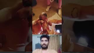 mother painful delivery newborn twins baby ! pain can't explain #shorts #ytshorts #trending #mbbs