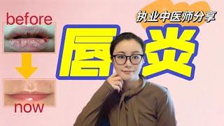 女中医的唇部护理分享