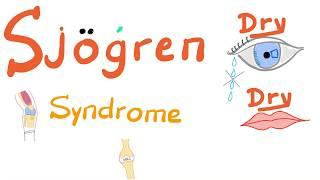 Sjögren Syndrome - Dry eyes, Dry mouth, Arthritis - Rheumatology Series