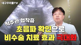 척추관 협착증 초음파 확인으로 비수술 치료 효과 극대화 ｜대구우리들병원