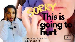 Pain After Dental Extraction... Episode 6: Smile Everyday Show