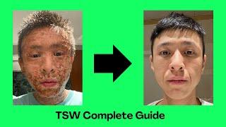 (TSW Complete Guide) Survivor's Guide to Topical Steroid Withdrawal