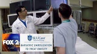 Bariatric Embolization is new option for obesity - SLUCare Health Watch