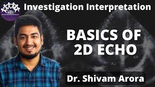 Basics of 2D ECHO