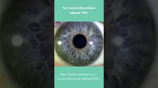 Behavioural Iridology - The Emotionally Driven Type