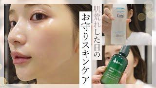 【スキンケア】肌荒れした日のスキンケア🫧 花粉でゆらいだ肌に効いたレスキューアイテム