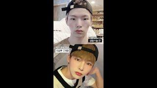 자연주의성형외과 남자눈성형+남자코성형+광대 수술전후 영상