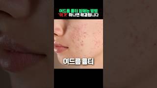 시술 광고 약국꿀템으로 집에서 쉽게 여드름 흉터 지우는 방법!