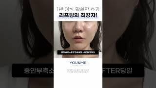 한번 받으면 또 받으러 오는 #이슈