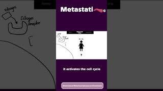 Breast Cancer Metastasis part 1