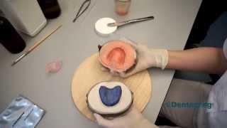 Dentapreg MESH denture reinforcement - instructional video