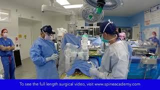 Surgical Case Trailer: Open Complex Spinal Fusion T9-S1