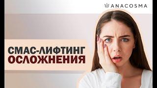 Ультразвуковой СМАС лифтинг ОСЛОЖНЕНИЯ |  Альтера |  Отзывы