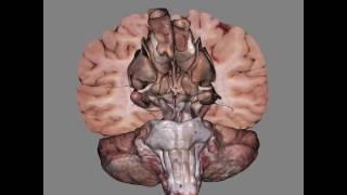 3D View Of Dissected Brain
