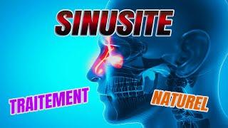 Sinusite Causes et traitement naturel de ce mal de tête