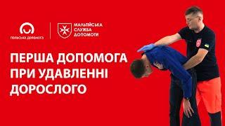 Перша допомога при удавленні дорослого