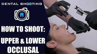 How to Shoot: UPPER   LOWER OCCLUSAL