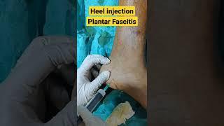 Heel Pain Injection  | Fast & Immediate Relief| #plantarfasciatis #heelpain #heelpaintreatment |