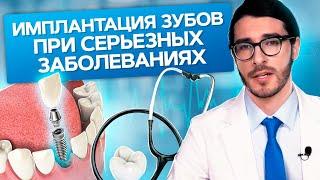 Имплантация зубов при серьезных заболеваниях. Возможна ли имплантация при серьезных заболеваниях?