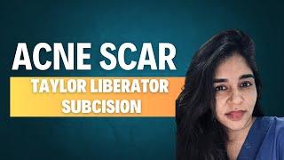 Erase Acne Scars with Taylor Liberator Subcision | Dr. Anvika’s Expert Guide