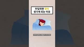 부딪히면 멍이 생기게 되는 이유 (30초 지식) #shorts