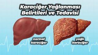 karaciğer yağlanması ve toksin atımı için mutlaka yapın