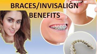10 Surprising Benefits of Braces & Invisalign!