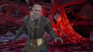 Beat Dettlaff on death march EASY Witcher 3 blood and wine [flawless]