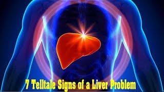 7 Telltale Signs of a Liver Problem - activebeat