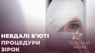 Невдалі б’юті процедури зірок: Камалія, Раміна Есхакзай, Влад Топалов | Зірковий шлях