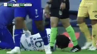 Lesion del burrito Hernández