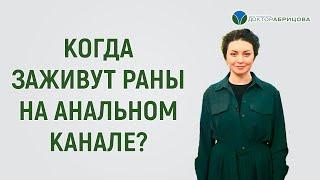 Когда заживут раны на анальном канале после операции? Отвечает Марьяна Абрицова