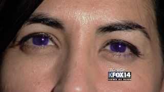 Special Assignment: Dangers of Cosmetic Contacts